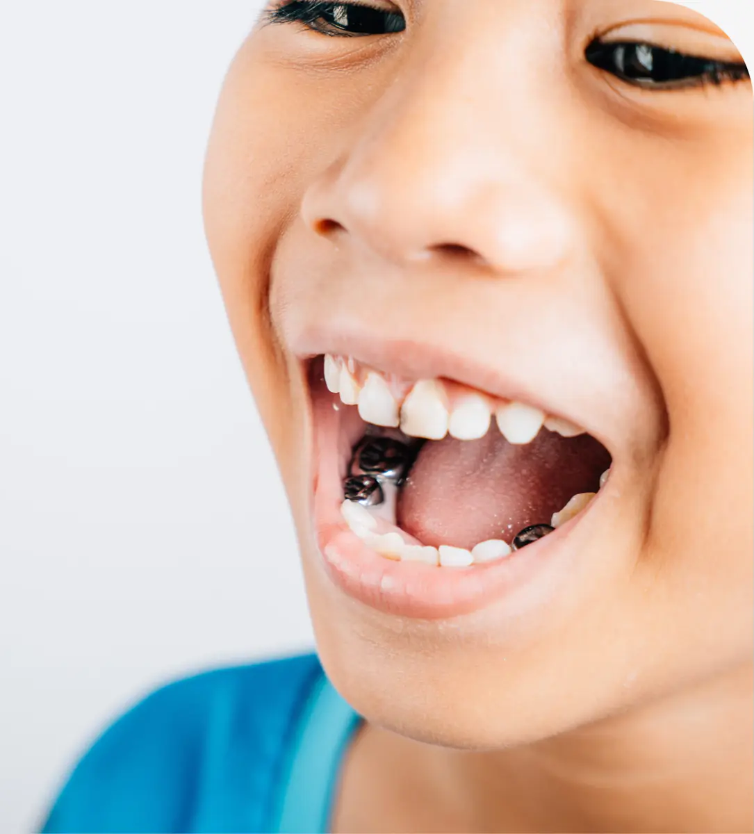 Children's dentistry at Brazos River Dental in Mineral Wells