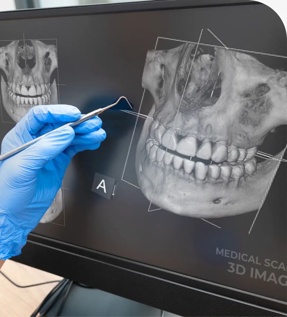 Cone beam CBCT 3D imaging at Brazos River Dental in Mineral Wells