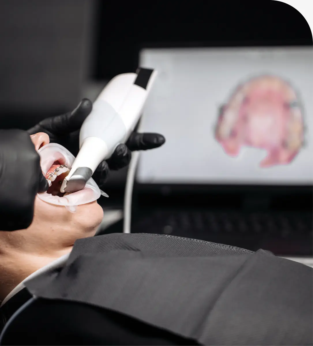 Digital X-ray imaging at Brazos River Dental in Mineral Wells